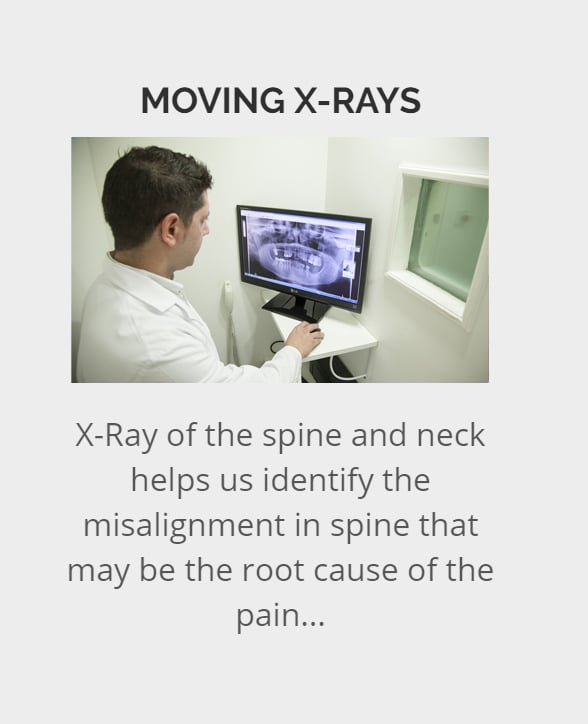 moving x-ray